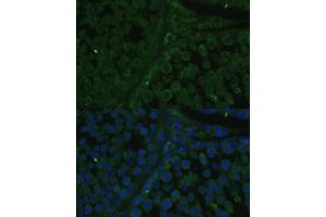 Immunofluorescence analysis of rat testis cells using IGF2BP2/IMP2 antibody (ABIN6131799, ABIN6142242, ABIN6142244 and ABIN6218878) at dilution of 1:100. (IGF2BP2 antibody  (AA 330-599))