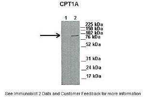 Lanes:   1. (CPT1A antibody  (Middle Region))