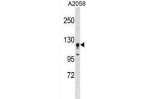 Western Blotting (WB) image for anti-serine/threonine Kinase 31 (STK31) antibody (ABIN3003073) (STK31 antibody)