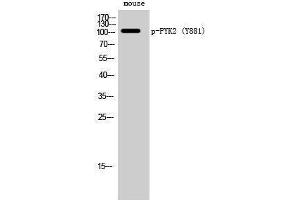 Western Blotting (WB) image for anti-PTK2B Protein tyrosine Kinase 2 beta (PTK2B) (pTyr881) antibody (ABIN3182495) (PTK2B antibody  (pTyr881))