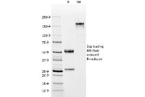 SDS-PAGE Analysis Purified Complement 4d Mouse Monoclonal Antibody (C4D204). (C4A antibody)