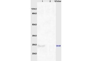 Lane 1: mouse brain lysates Lane 2: mouse kidney lysates probed with Anti CHAC1 Polyclonal Antibody, Unconjugated (ABIN872557) at 1:200 in 4 °C. (CHAC1 antibody  (AA 131-222))