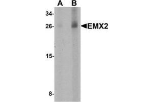 Western blot analysis of EMX2 in human lung tissue lysate with EMX2 Antibody at (A) 1 and (B) 2 µg/ml. (EMX2 antibody  (Middle Region))