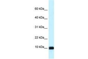 Image no. 1 for anti-Calmodulin Like Protein 3 (CALML3) (AA 63-112) antibody (ABIN6747652) (CALML3 antibody  (AA 63-112))