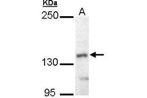 WB Image Sample (30 ug of whole cell lysate) A: Hep G2 , 5% SDS PAGE antibody diluted at 1:10000 (UBE4B antibody  (C-Term))