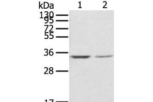 Western Blot analysis of NIH/3T3 and Jurkat cell using RACK1 Polyclonal Antibody at dilution of 1:300 (GNB2L1 antibody)
