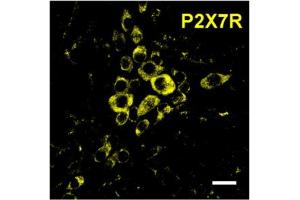 Expression of P2X7 receptor in mouse longitudinal muscle-myenteric plexus sections.