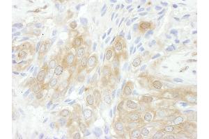 Immunohistochemistry (IHC) image for anti-14-3-3 theta (YWHAQ) (AA 195-245) antibody (ABIN7453416)