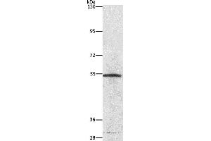 Western blot analysis of Lovo cell, using NEK2 Polyclonal Antibody at dilution of 1:727 (NEK2 antibody)