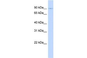 WB Suggested Anti-ZNF226 Antibody Titration:  0. (ZNF226 antibody  (N-Term))