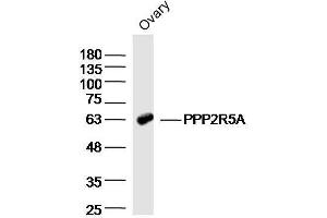 anti-Protein Phosphatase 2, Regulatory Subunit B' alpha (PPP2R5A) (AA 301-400) antibody