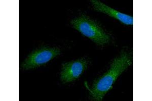 ICC/IF analysis of ISG15 in HeLa cells line, stained with DAPI (Blue) for nucleus staining and monoclonal anti-human ISG15 antibody (1:100) with goat anti-mouse IgG-Alexa fluor 488 conjugate (Green). (ISG15 antibody)