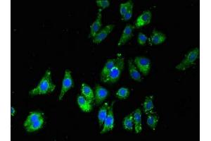 Immunofluorescent analysis of HepG2 cells using ABIN7150873 at dilution of 1:100 and Alexa Fluor 488-congugated AffiniPure Goat Anti-Rabbit IgG(H+L) (Dnah5 antibody  (AA 2364-2560))