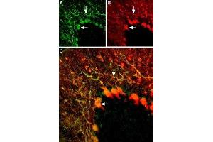 Expression of KV1. (KCNA5 antibody  (1st Extracellular Loop))