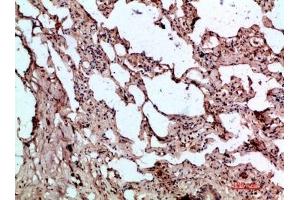 Immunohistochemical analysis of paraffin-embedded human-lung, antibody was diluted at 1:200.