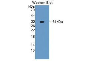 Detection of Recombinant ADAM12, Human using Polyclonal Antibody to A Disintegrin And Metalloprotease 12 (ADAM12) (ADAM12 antibody  (AA 513-767))