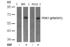 Western blot analysis of extracts from 293 and PC12 cells untreated or treated with EGF using PDK1(Phospho-Ser241) Antibody. (PDPK1 antibody  (pSer241))