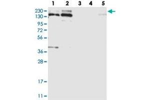 Western blot analysis of Lane 1: RT-4, Lane 2: U-251 MG, Lane 3: Human Plasma, Lane 4: Liver, Lane 5: Tonsil with SNRNP200 polyclonal antibody  at 1:250-1:500 dilution. (SNRNP200 antibody)