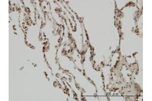 Image no. 1 for anti-NF-kappa-B inhibitor beta (NFKBIB) (AA 56-145) antibody (ABIN598839) (NFKBIB antibody  (AA 56-145))