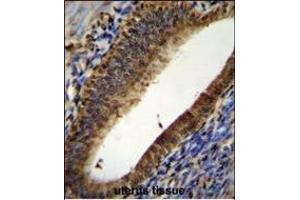 PT Antibody (N-term) (ABIN655715 and ABIN2845165) immunohistochemistry analysis in forlin fixed and paraffin embedded hun uterus tissue followed by peroxidase conjugation of the secondary antibody and DAB staining. (PTMA antibody  (N-Term))