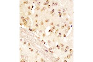 (ABIN6243925 and ABIN6578096) staining (Mouse) Pou5f1 in mouse brain sections by Immunohistochemistry (IHC-P - paraformaldehyde-fixed, paraffin-embedded sections). (OCT4 antibody  (N-Term))
