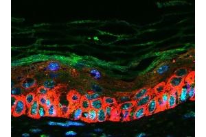 Images kindly provided by Dr. (CXCL16 antibody  (AA 85-200))