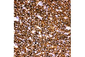 Anti-CD20 Picoband antibody,  IHC(P): Human Tonsil Tissue (CD20 antibody  (AA 1-261))