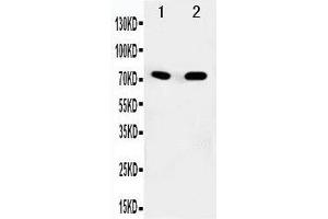 Anti-SDHA antibody, Western blotting Lane 1: Rat Heart Tissue Lysate Lane 2: COLO320 Cell Lysate (SDHA antibody  (N-Term))