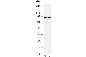 Western blot testing of MCM3 antibody and Lane 1:  HeLa;  2: Jurkat cell lysate.