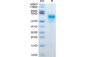 Mouse IL-1R2 on Tris-Bis PAGE under reduced condition. (IL1R2 Protein (AA 14-355) (His tag))