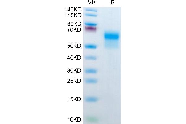 IL1R2 Protein (AA 14-355) (His tag)