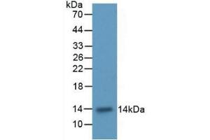 Western blot analysis of recombinant Rat ITGaM. (CD11b antibody  (AA 598-700))