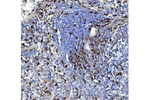 IHC analysis of CD90/Thy1 using anti-CD90/Thy1 antibody (ABIN5518877). (CD90 antibody  (AA 20-131))