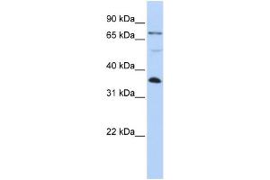 WB Suggested Anti-LASP1 Antibody Titration: 0. (LASP1 antibody  (C-Term))
