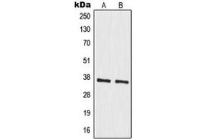 Western blot analysis of MRPS35 expression in A549 (A), HeLa (B) whole cell lysates. (MRPS35 antibody  (Center))