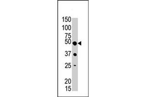 The PIGK polyclonal antibody  is used in Western blot to detect PIGK in mouse liver tissue lysate . (PIGK antibody  (C-Term))