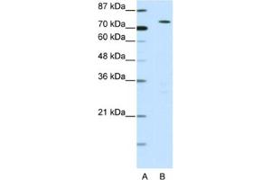 Western Blotting (WB) image for anti-MYST Histone Acetyltransferase 2 (MYST2) antibody (ABIN2460592) (MYST2 antibody)
