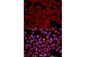 Immunofluorescence analysis of U2OS cells using PPP1CB antibody. (PPP1CB antibody  (AA 1-327))