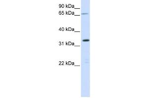 Western Blotting (WB) image for anti-Chromosome 19 Open Reading Frame 47 (C19orf47) antibody (ABIN2459199) (C19orf47 antibody)