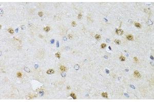 Immunohistochemistry of paraffin-embedded Rat brain using CMAS Polyclonal Antibody at dilution of 1:150 (40x lens).