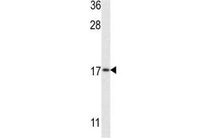 Western blot analysis of LC3II antibody and MCF-7 lysate (LC3B antibody  (AA 74-106))