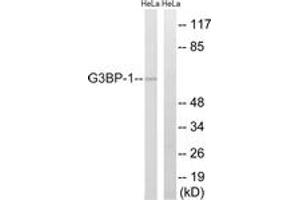 Western Blotting (WB) image for anti-GTPase Activating Protein (SH3 Domain) Binding Protein 1 (G3BP1) (AA 199-248) antibody (ABIN2888993) (G3BP1 antibody  (AA 199-248))