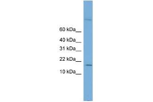 WB Suggested Anti-CST8 Antibody Titration: 0. (CST8 antibody  (Middle Region))