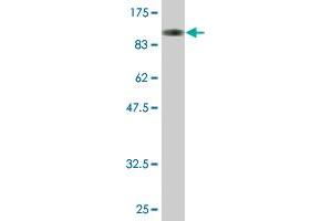 Western Blot detection against Immunogen (100. (ZNF263 antibody  (AA 1-683))