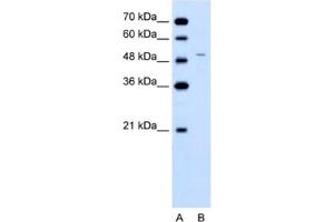 Western Blotting (WB) image for anti-Ferrochelatase (FECH) antibody (ABIN2462486)