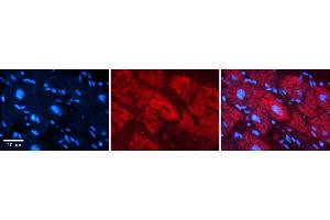 Rabbit Anti-NFATC1 Antibody    Formalin Fixed Paraffin Embedded Tissue: Human Adult heart  Observed Staining: Nuclear, Cytoplasmic Primary Antibody Concentration: 1:600 Secondary Antibody: Donkey anti-Rabbit-Cy2/3 Secondary Antibody Concentration: 1:200 Magnification: 20X Exposure Time: 0.