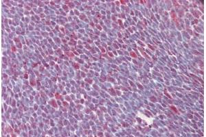 Human Thymus (formalin-fixed, paraffin-embedded) stained with SFRS1 antibody ABIN461956 at 10 ug/ml followed by biotinylated anti-mouse IgG secondary antibody ABIN481714, alkaline phosphatase-streptavidin and chromogen. (SRSF1 antibody  (N-Term))