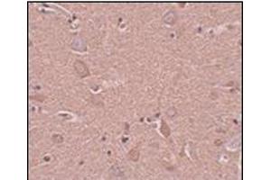 Immunohistochemistry of SRPX1 in human brain tissue with this product at 5 μg/ml. (SRPX antibody  (N-Term))