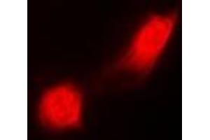 Immunofluorescent analysis of PSMC2 staining in MCF7 cells. (PSMC2 antibody)