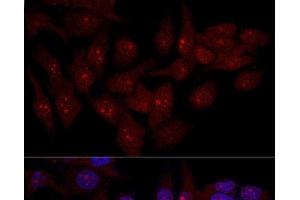 Confocal immunofluorescence analysis of Hela cells using EIF6 Polyclonal Antibody at dilution of 1:50. (EIF6 antibody)